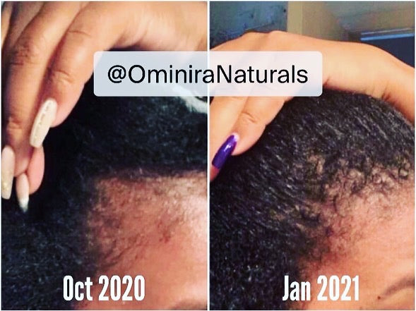 Follicle Fuel – Hair Growth Potion